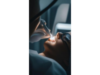 激光洗紋身全過程你了解嗎？