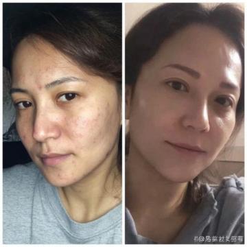 下班后自己做飯，小琳三個(gè)月瘦6厘米，皮膚變好！